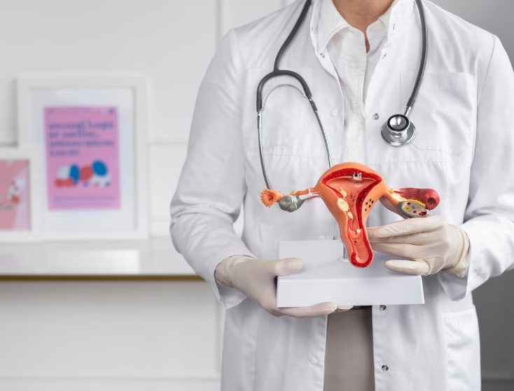 fibroids treatment in greater noida
